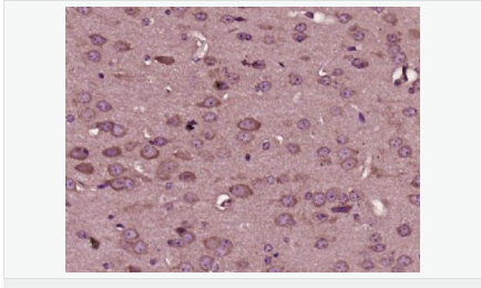 6052ab62d3cf1.png image.png