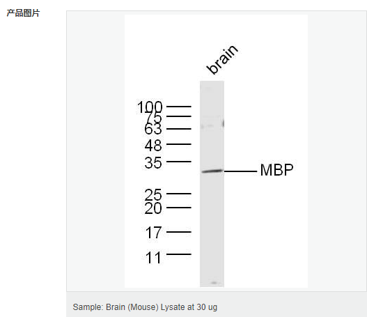 6054101f1a595.png image.png