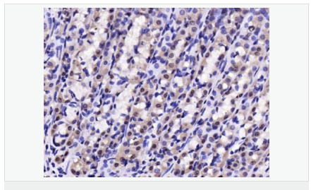 60543fa89127e.png image.png