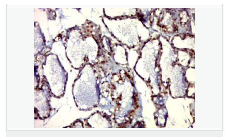 605d918a5be1d.png image.png