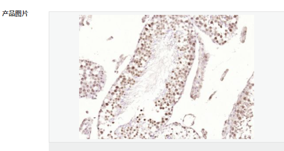 6077fa2102183.png image.png